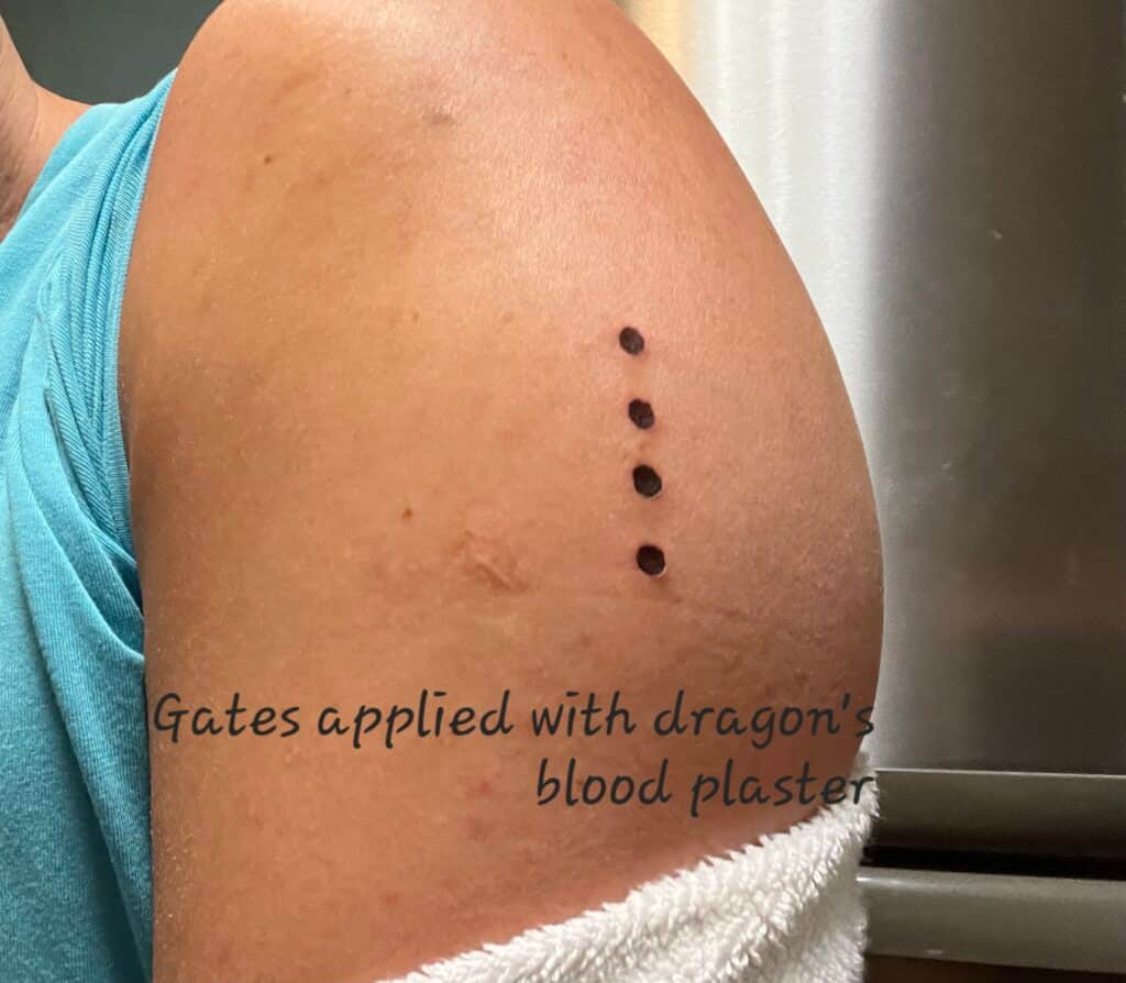 Kambo Healing Temple 5